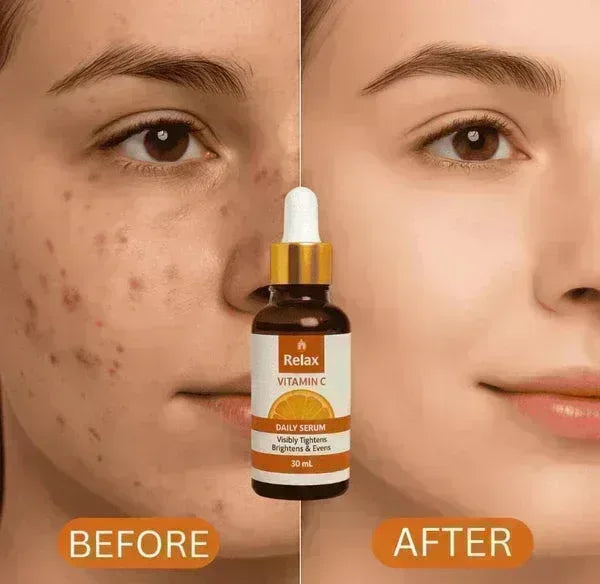 Relax Vitamin C Serum: Bring Back Your Skin’s Natural Glow - Choice Corner